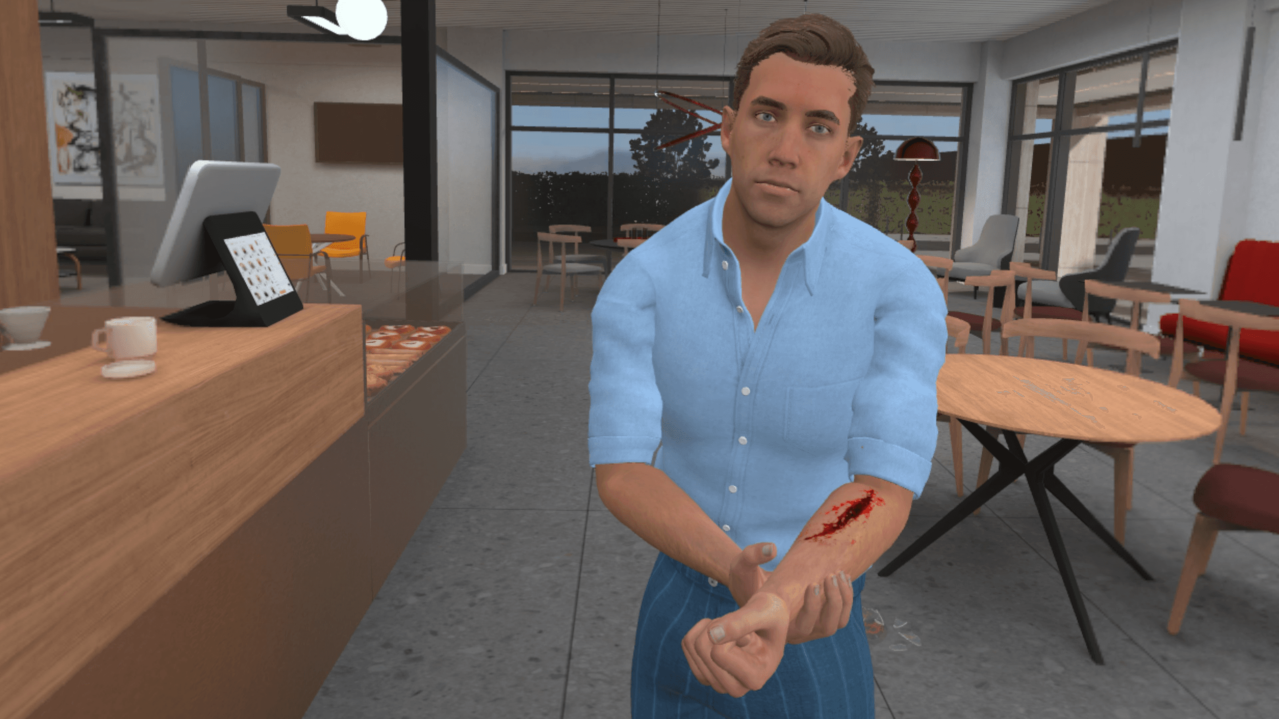 Ein Mann in einem café-artigen Büro zeigt eine blutende Armwunde, bevor sie versorgt wird.
